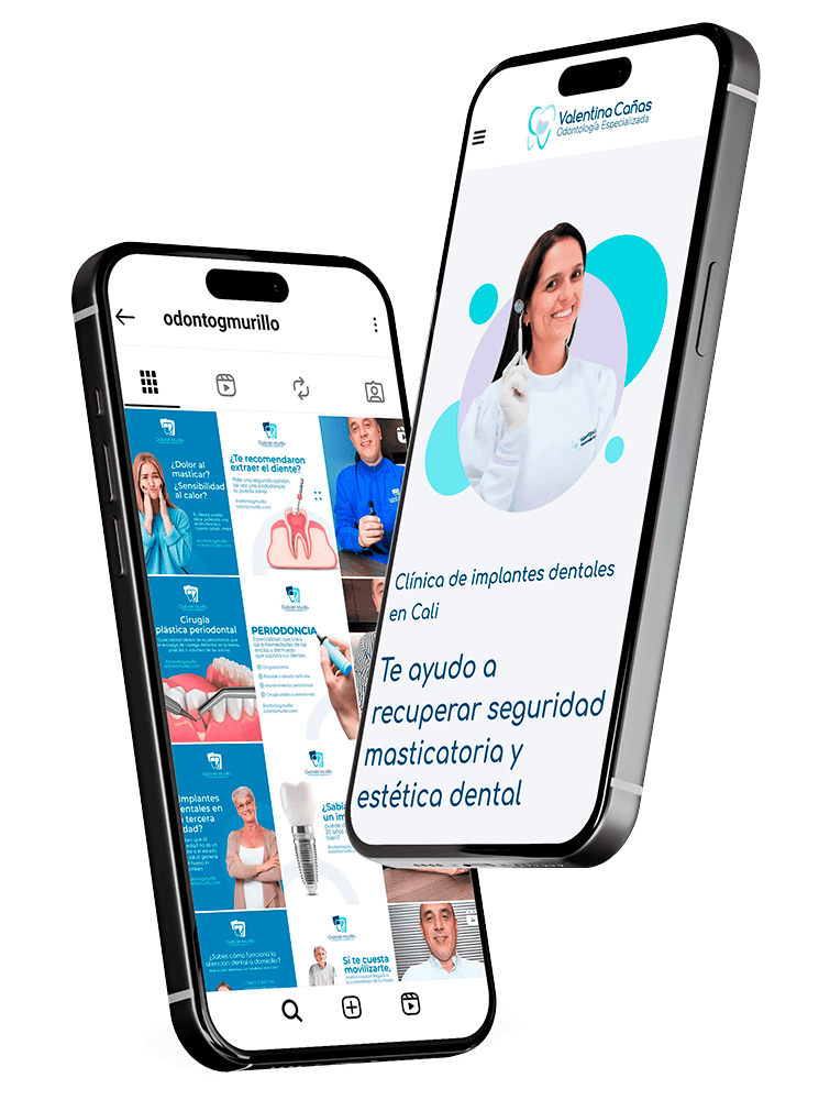 Imagen de dos celulares con redes sociales de odontólogos clientes de Odonto Creativos